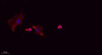 CLC10 Polyclonal Antibody