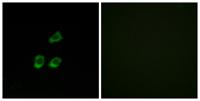 CLC-4 Polyclonal Antibody