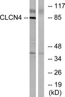 CLC-4 Polyclonal Antibody