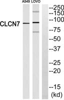 CLC-7 Polyclonal Antibody