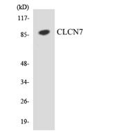 CLC-7 Polyclonal Antibody