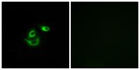 CLCC1 Polyclonal Antibody