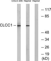 CLCC1 Polyclonal Antibody