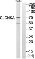 CLC-KA Polyclonal Antibody