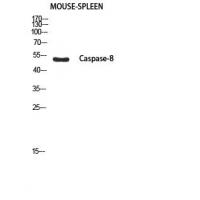 Cleaved-Caspase-8 p18 (S217) Polyclonal Antibody