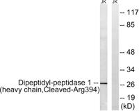 Cleaved-Cathepsin C HC (R394) Polyclonal Antibody
