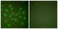 Rpb1 Polyclonal Antibody
