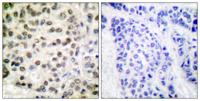 Rpb1 Polyclonal Antibody