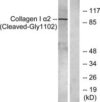 Cleaved-COL1A2 (G1102) Polyclonal Antibody