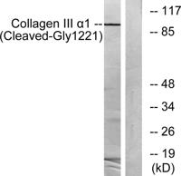 Cleaved-COL3A1 (G1221) Polyclonal Antibody