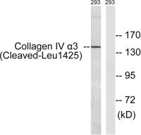 Cleaved-COL4A3 (L1425) Polyclonal Antibody