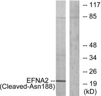 Cleaved-Ephrin-A2 (N188) Polyclonal Antibody