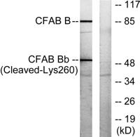 Cleaved-Factor B Bb (K260) Polyclonal Antibody