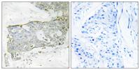 Cleaved-Factor VII LC (R212) Polyclonal Antibody