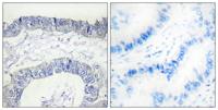 Cleaved-Factor XII HC (I20) Polyclonal Antibody