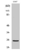 Cleaved-Integrin α7 LC (E959) Polyclonal Antibody