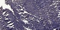 Cleaved-ITI-H4 70k (R661) Polyclonal Antibody
