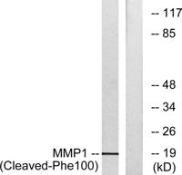 Cleaved-MMP-1 22k (F100) Polyclonal Antibody