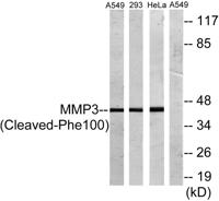 Cleaved-MMP-3 (F100) Polyclonal Antibody