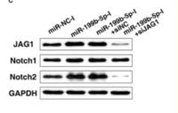 Cleaved-Notch 1 (V1754) Polyclonal Antibody