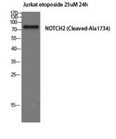 Cleaved-Notch 2 (A1734) Polyclonal Antibody