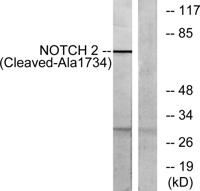 Cleaved-Notch 2 (A1734) Polyclonal Antibody