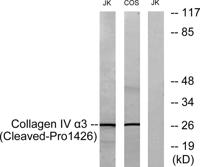 Cleaved-Tumstatin (P1426) Polyclonal Antibody
