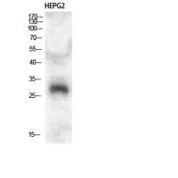 CLECSF6 Polyclonal Antibody