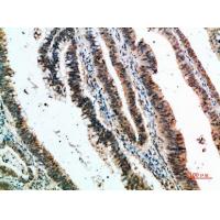 CLECSF6 Polyclonal Antibody