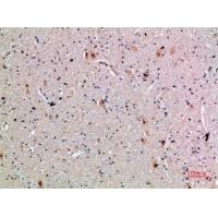 CLECSF6 Polyclonal Antibody