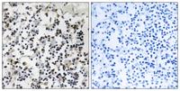 CLIC4 Polyclonal Antibody