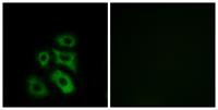 CLIP3 Polyclonal Antibody