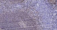 CLIP3 Polyclonal Antibody