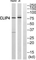 CLIP4 Polyclonal Antibody