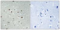 CLK2 Polyclonal Antibody
