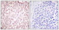 CLLD7 Polyclonal Antibody
