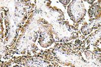 CLN1 Polyclonal Antibody