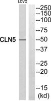 CLN5 Polyclonal Antibody