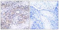 CLN6 Polyclonal Antibody
