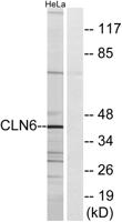 CLN6 Polyclonal Antibody