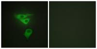 CLP36 Polyclonal Antibody