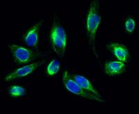 Clusterin Polyclonal Antibody