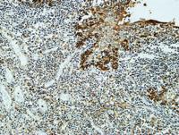 Clusterin Polyclonal Antibody