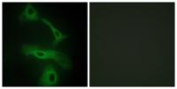 Clusterin Polyclonal Antibody