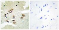 Clusterin Polyclonal Antibody