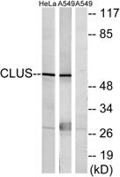 Clusterin Polyclonal Antibody