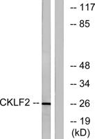 CMTM2 Polyclonal Antibody