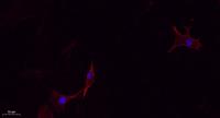 CMTM4 Polyclonal Antibody