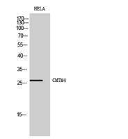 CMTM4 Polyclonal Antibody