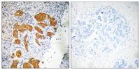 CMTM4 Polyclonal Antibody